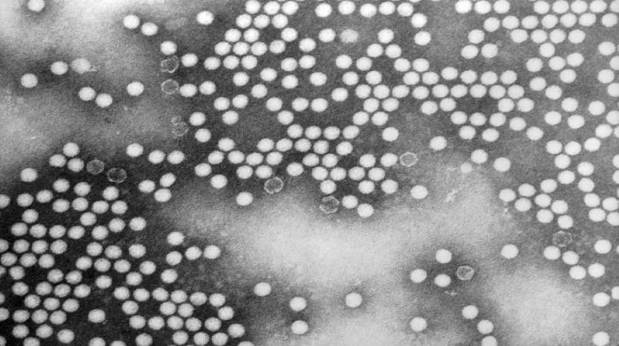 Transmission electron microscope image of poliovirus particles.